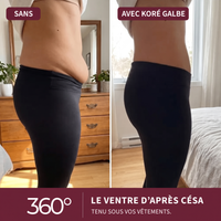 Sans et avec Koré Galbe : le ventre d’après césarienne tenu sous les vêtements